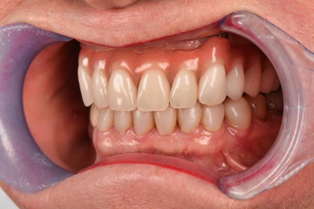 close-up shot of a person's teeth