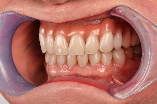close-up shot of a person's teeth