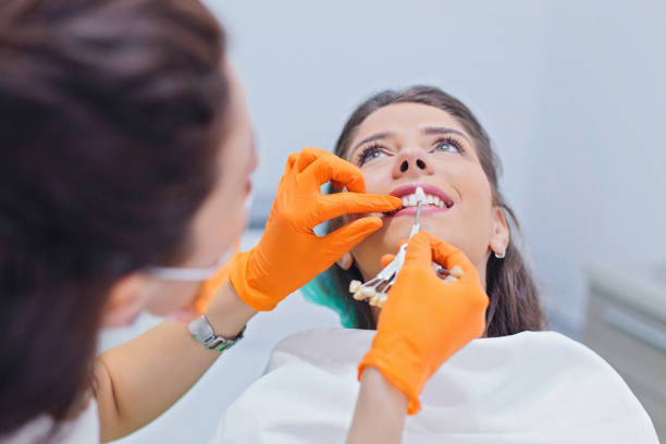 image showing a dentist trying to match a dental veneer in a patient