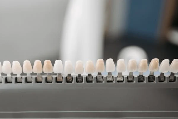 a  palette of veneers