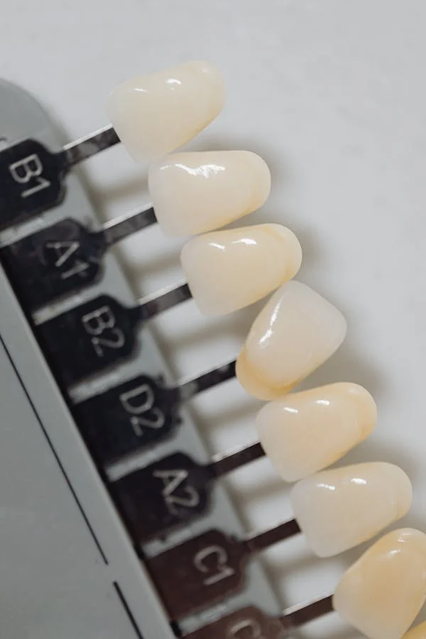 dental veneers model