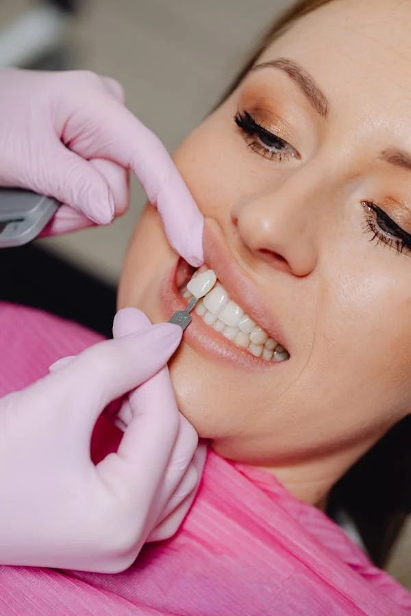 image of a woman during a veneers fitting