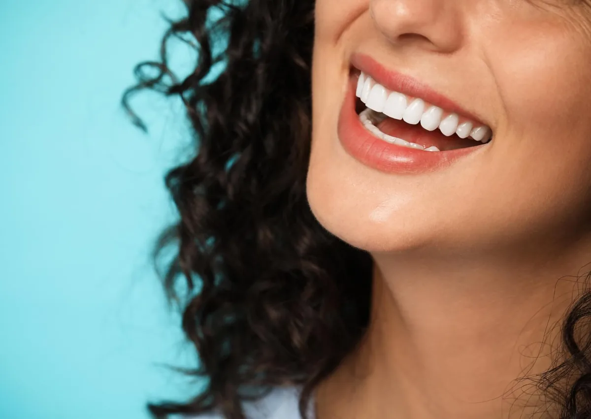 Close-up of a bright smile showing the cosmetic results patients may consider when evaluating dental veneers cost.