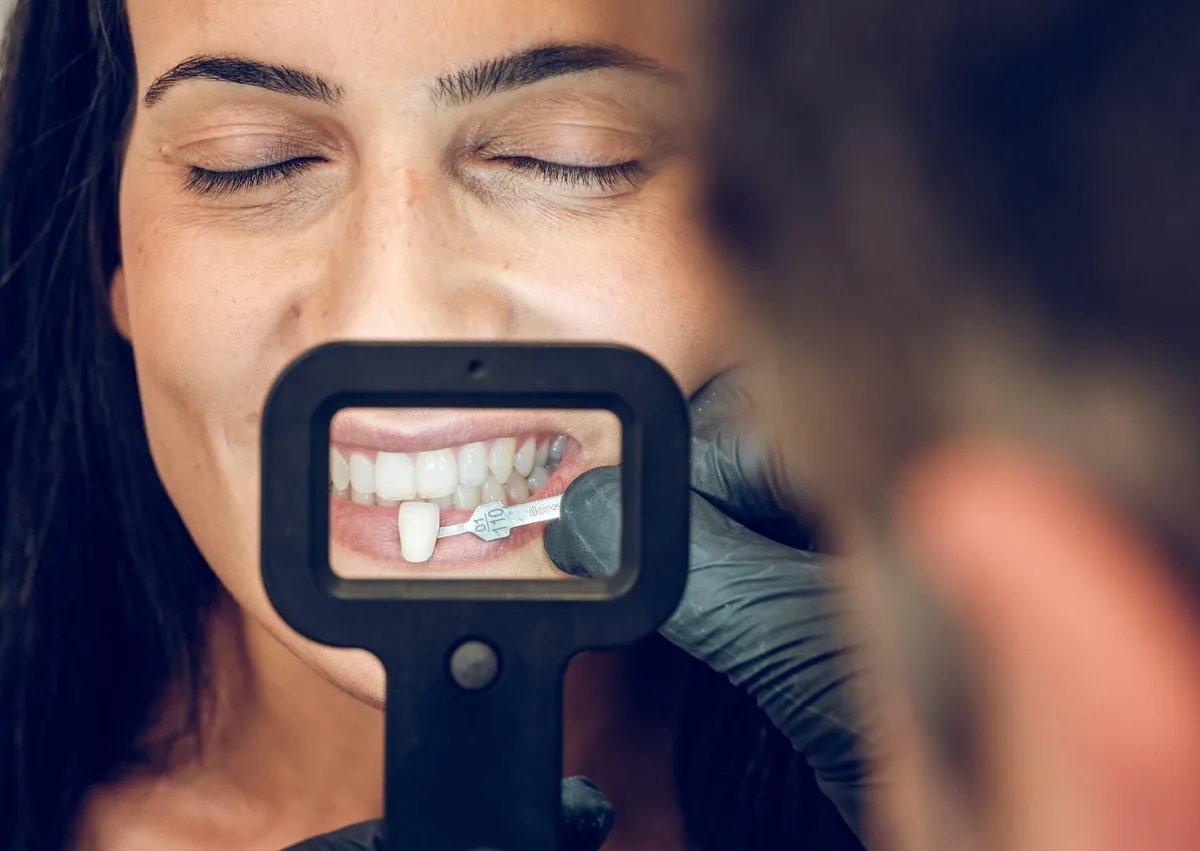 Dentist matching tooth shade for veneers designed to improve the appearance of crooked teeth.